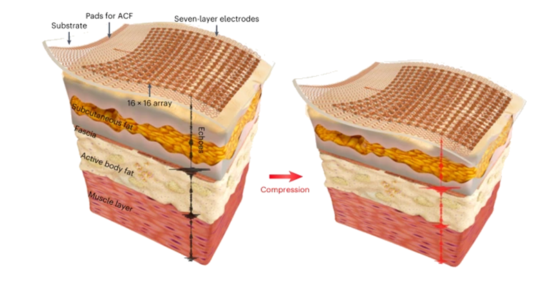 Illustration of the elastography system