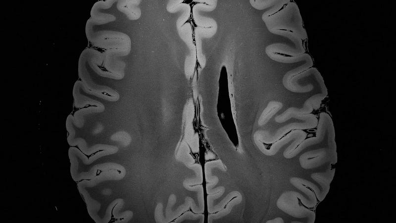 Container designed for brain MRI scanning