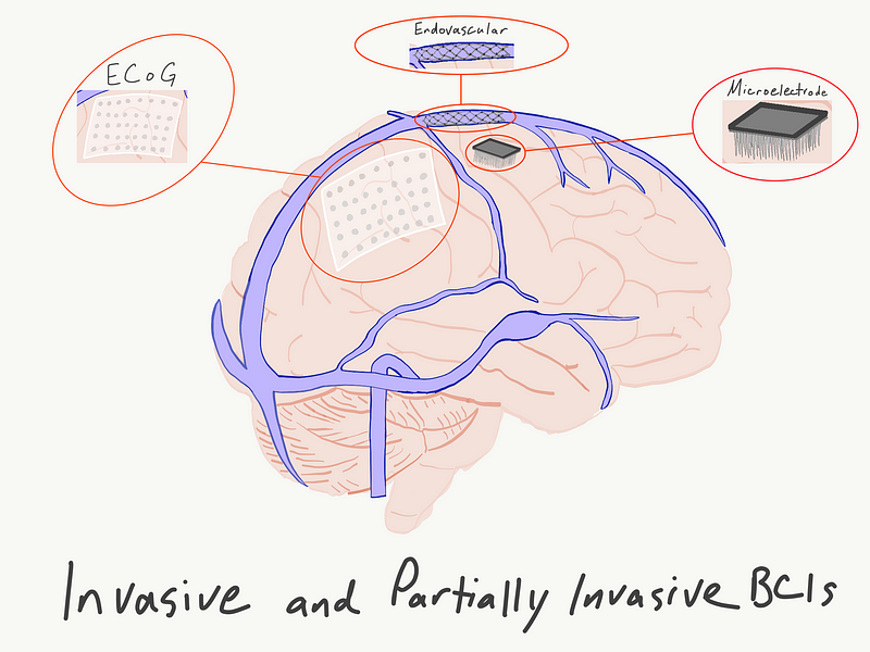 Visual representation of brain signal processing