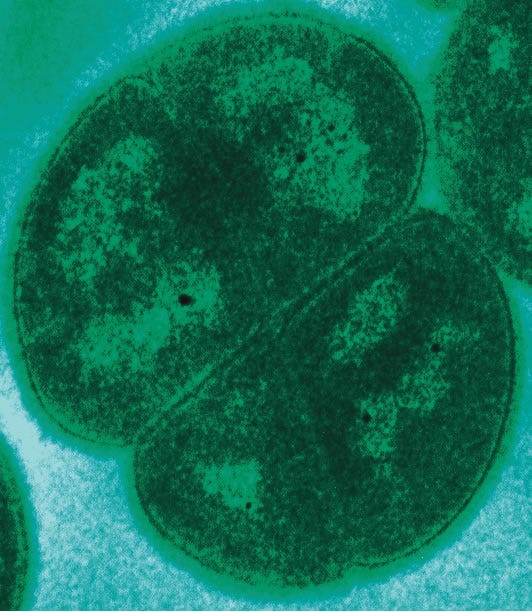 Deinococcus radiodurans under an electron microscope