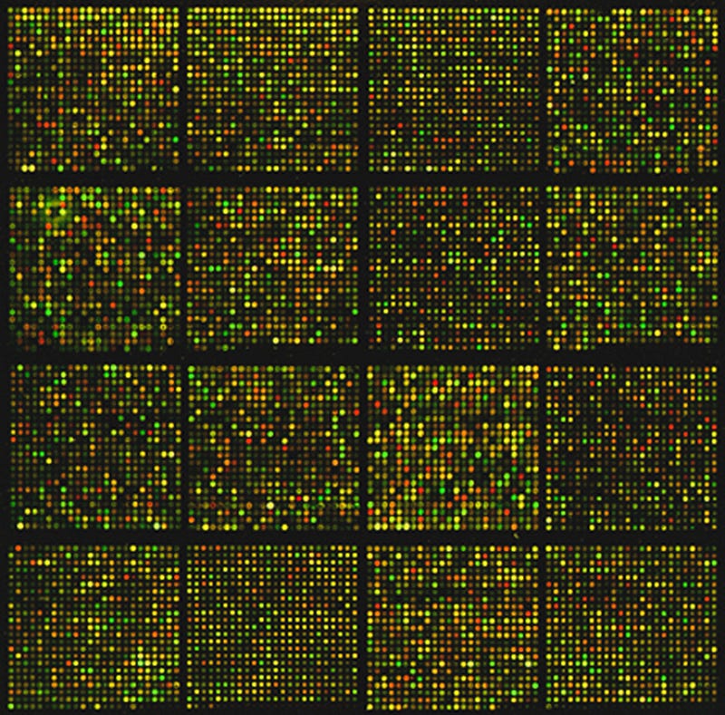 A mouse cDNA microarray reflecting gene expression differences